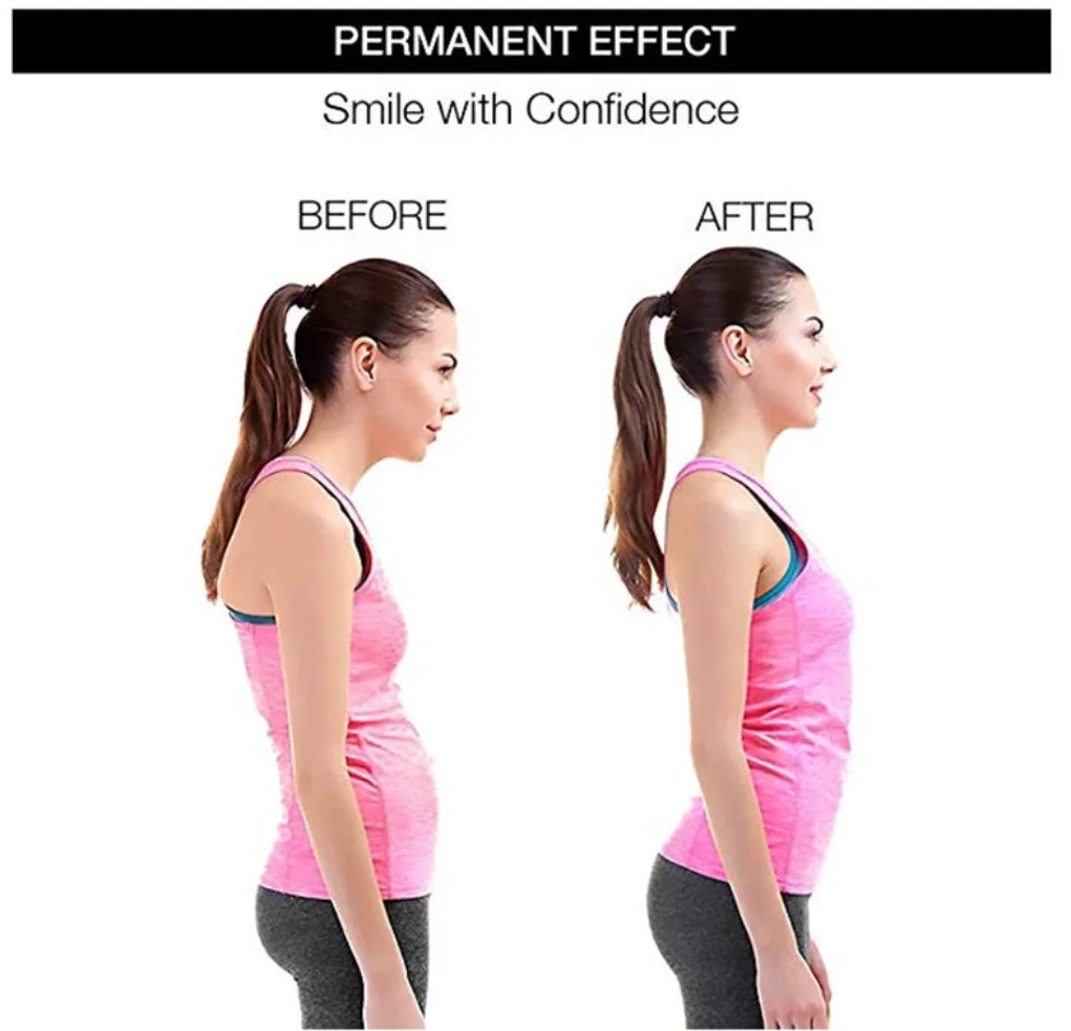 HiGyms Posture Corrector